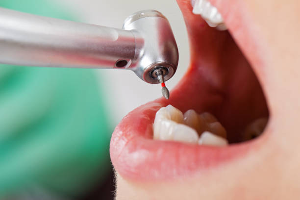Best Pediatric Emergency Dentist in Kidron, OH